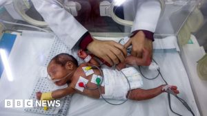 Enam bayi meninggal karena kedinginan dalam dua minggu, kata petugas medis